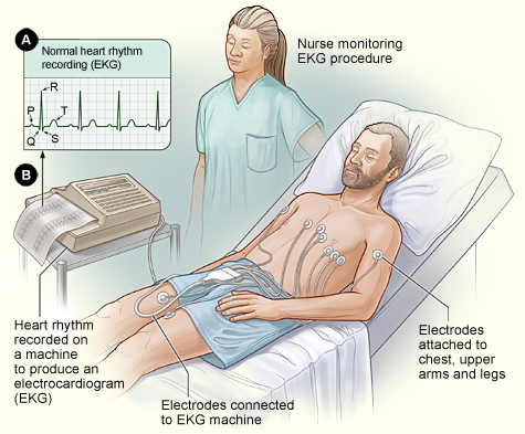 Clinic ECG