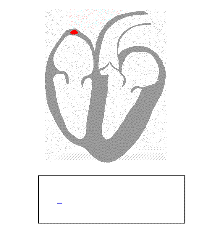 Cardiac cycle animation Source: By Kalumet - selbst erstellt = Own work, CC BY-SA 3.0, https://commons.wikimedia.org/w/index.php?curid=438140